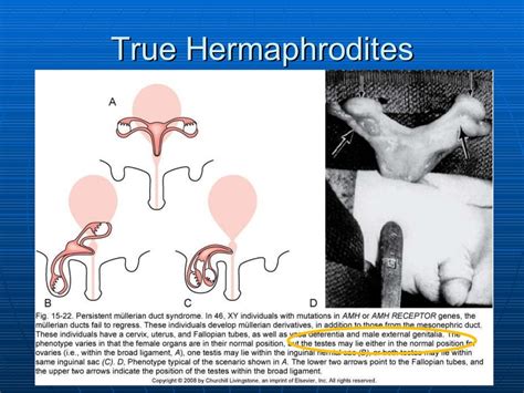 Pregnancy in true hermaphrodites and all male offspring to date